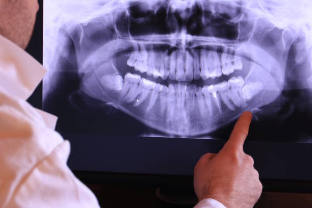 Best Emergency Dental Care for Broken or Chipped Teeth in Mcminnville, OR