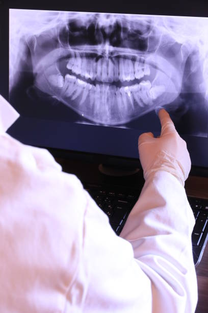 Best Emergency Wisdom Teeth Removal in Mcminnville, OR