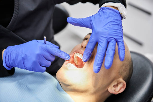 Best Emergency Dental Care for Broken or Chipped Teeth in Mcminnville, OR